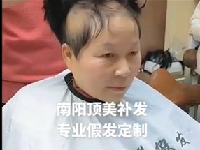 南陽女士假發(fā)補發(fā)